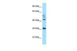 ATCAY Antibody, Novus Biologicals 100 &mu;L; Unconjugated:Antibodies, Polyclonal